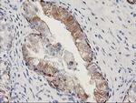MGLL Antibody in Immunohistochemistry (Paraffin) (IHC (P))