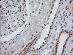 MGLL Antibody in Immunohistochemistry (Paraffin) (IHC (P))