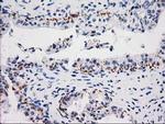 MGLL Antibody in Immunohistochemistry (Paraffin) (IHC (P))