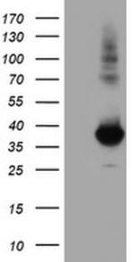 MGLL Antibody in Western Blot (WB)