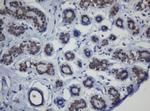 MGMT Antibody in Immunohistochemistry (Paraffin) (IHC (P))