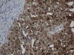 MGMT Antibody in Immunohistochemistry (Paraffin) (IHC (P))