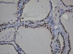 MGMT Antibody in Immunohistochemistry (Paraffin) (IHC (P))