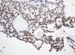 MGMT Antibody in Immunohistochemistry (Paraffin) (IHC (P))