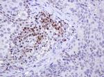 MGMT Antibody in Immunohistochemistry (Paraffin) (IHC (P))