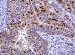 MGMT Antibody in Immunohistochemistry (Paraffin) (IHC (P))