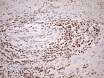 MGMT Antibody in Immunohistochemistry (Paraffin) (IHC (P))