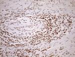 MGMT Antibody in Immunohistochemistry (Paraffin) (IHC (P))