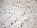 MGMT Antibody in Immunohistochemistry (Paraffin) (IHC (P))