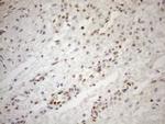 MGMT Antibody in Immunohistochemistry (Paraffin) (IHC (P))