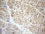 MGMT Antibody in Immunohistochemistry (Paraffin) (IHC (P))