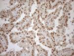 MGMT Antibody in Immunohistochemistry (Paraffin) (IHC (P))