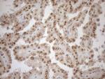 MGMT Antibody in Immunohistochemistry (Paraffin) (IHC (P))