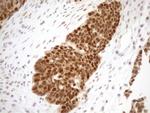 MGMT Antibody in Immunohistochemistry (Paraffin) (IHC (P))