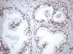 MGMT Antibody in Immunohistochemistry (Paraffin) (IHC (P))