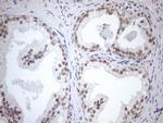 MGMT Antibody in Immunohistochemistry (Paraffin) (IHC (P))