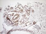 MGMT Antibody in Immunohistochemistry (Paraffin) (IHC (P))