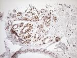 MGMT Antibody in Immunohistochemistry (Paraffin) (IHC (P))