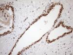 MGMT Antibody in Immunohistochemistry (Paraffin) (IHC (P))