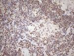 MGMT Antibody in Immunohistochemistry (Paraffin) (IHC (P))