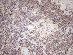 MGMT Antibody in Immunohistochemistry (Paraffin) (IHC (P))