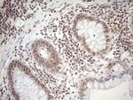 MGMT Antibody in Immunohistochemistry (Paraffin) (IHC (P))