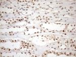 MGMT Antibody in Immunohistochemistry (Paraffin) (IHC (P))
