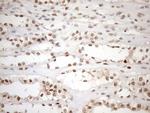 MGMT Antibody in Immunohistochemistry (Paraffin) (IHC (P))