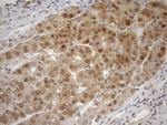 MGMT Antibody in Immunohistochemistry (Paraffin) (IHC (P))