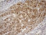 MGMT Antibody in Immunohistochemistry (Paraffin) (IHC (P))