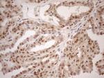 MGMT Antibody in Immunohistochemistry (Paraffin) (IHC (P))