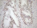 MGMT Antibody in Immunohistochemistry (Paraffin) (IHC (P))