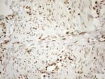 MGMT Antibody in Immunohistochemistry (Paraffin) (IHC (P))