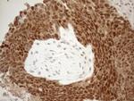 MGMT Antibody in Immunohistochemistry (Paraffin) (IHC (P))