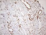 MGMT Antibody in Immunohistochemistry (Paraffin) (IHC (P))