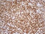 MGMT Antibody in Immunohistochemistry (Paraffin) (IHC (P))