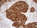 MGMT Antibody in Immunohistochemistry (Paraffin) (IHC (P))