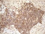 MGMT Antibody in Immunohistochemistry (Paraffin) (IHC (P))