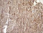 MGMT Antibody in Immunohistochemistry (Paraffin) (IHC (P))