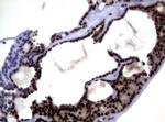 MGMT Antibody in Immunohistochemistry (Paraffin) (IHC (P))