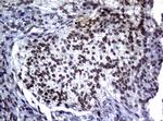 MGMT Antibody in Immunohistochemistry (Paraffin) (IHC (P))