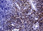 MGMT Antibody in Immunohistochemistry (Paraffin) (IHC (P))