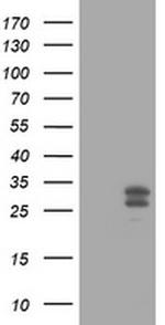 MGMT Antibody in Western Blot (WB)