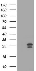 MGMT Antibody in Western Blot (WB)