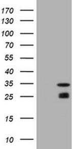 MGMT Antibody in Western Blot (WB)