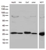 MGMT Antibody in Western Blot (WB)