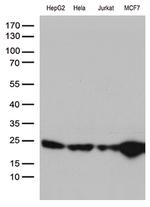 MGMT Antibody in Western Blot (WB)