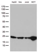 MGMT Antibody in Western Blot (WB)