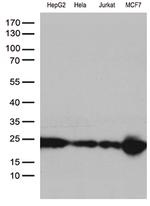 MGMT Antibody in Western Blot (WB)