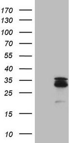 MGMT Antibody in Western Blot (WB)